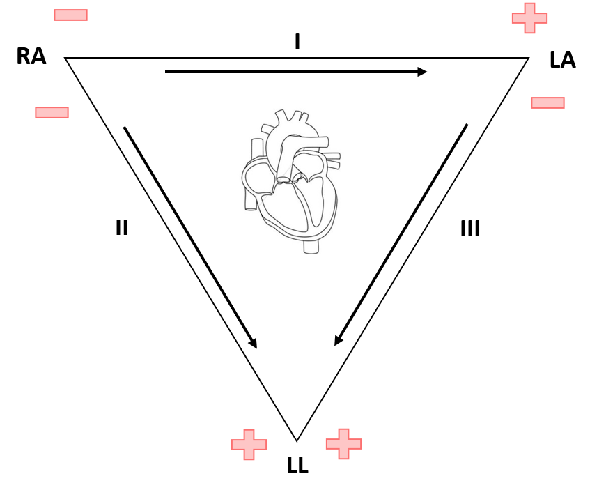 einthovens_triangle