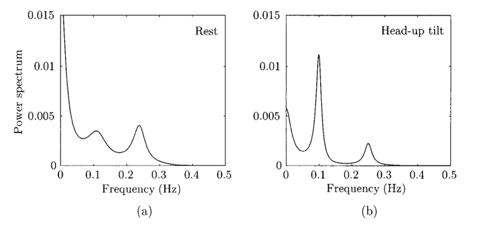 ECG_power_spectrum