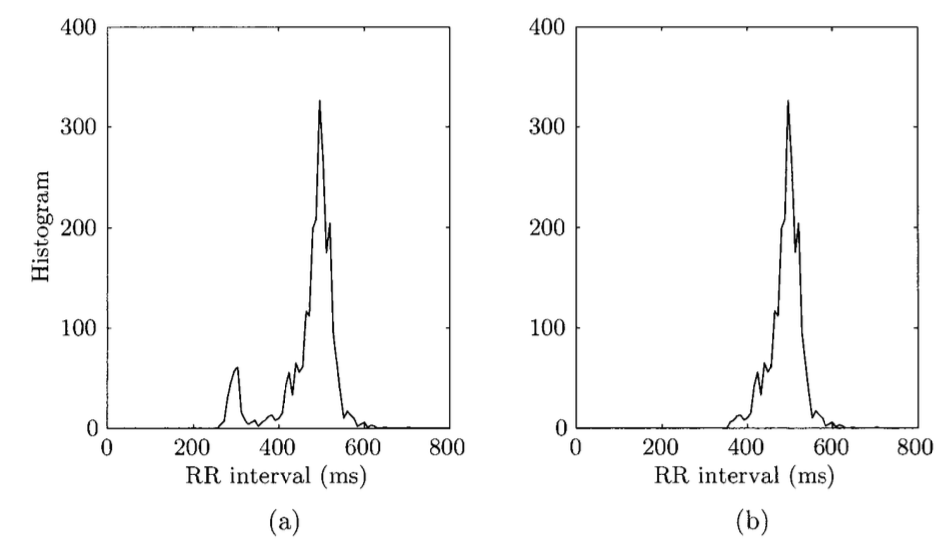 RR_interval_histogram