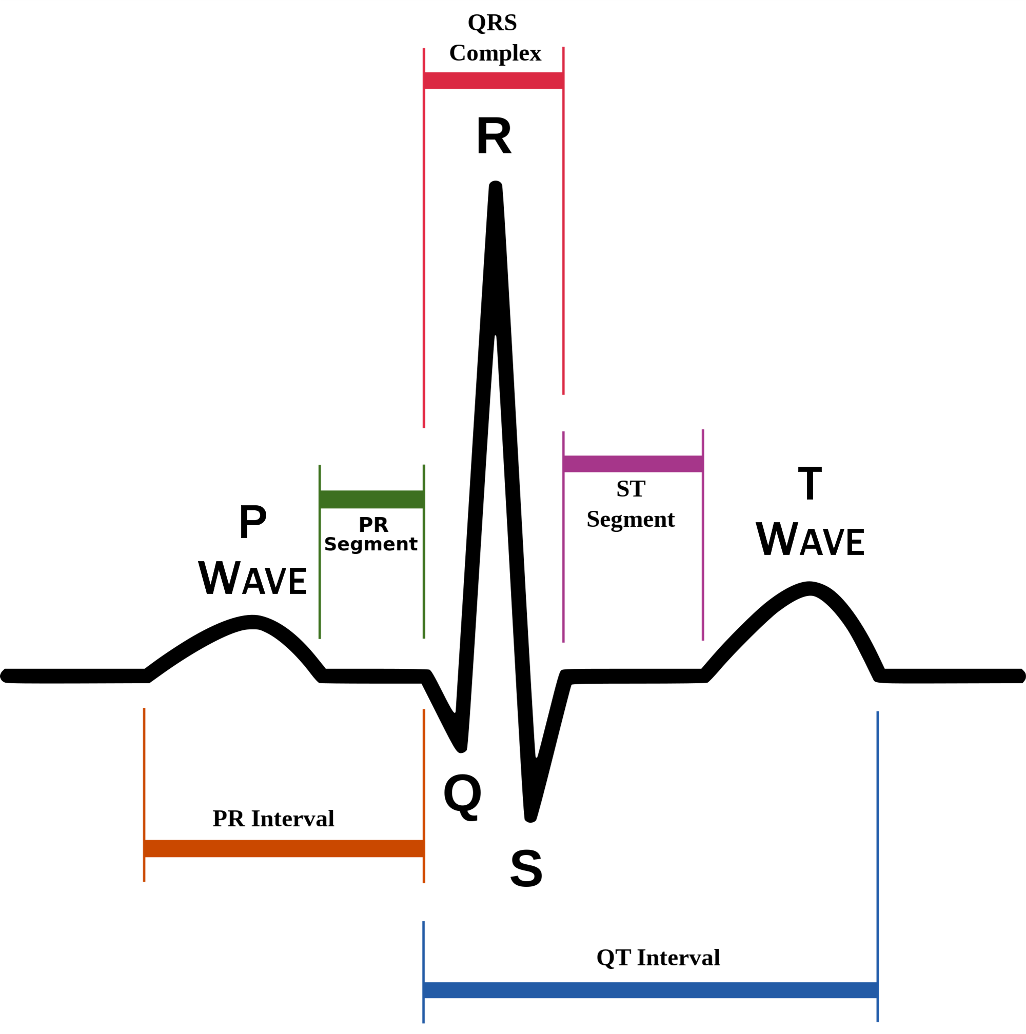 ECG_waveform