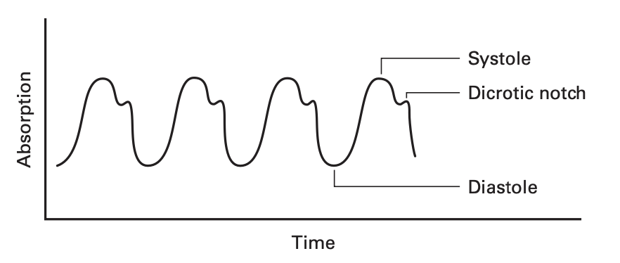 photoplethysmogram